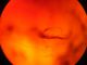 insetto 2_R.jpg