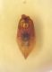 Anotylus M edeago 2.JPG