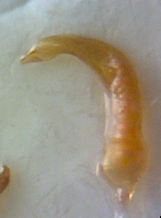 Adelphocoris genitalia.jpg
