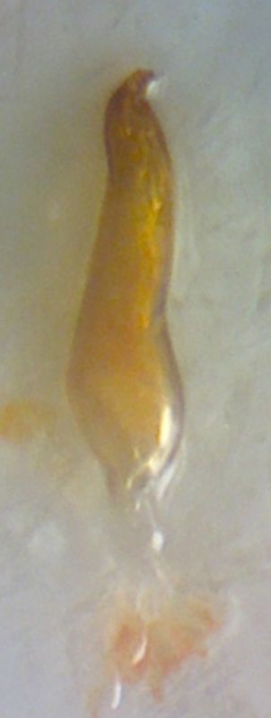 Adelphocoris genitalia2.jpg