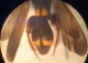 Leucospis_culo.png