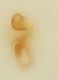 resized75-Atheta_fungi_g_5x_AB-716777098681168932.jpg