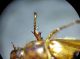 Tibia anteriore.jpg