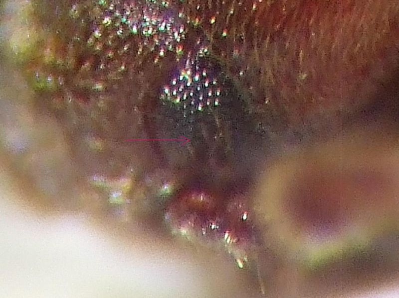 Cal particol occhio 001.jpg