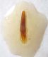 Stenosis 1 edeago.JPG