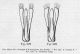 Aulonogyrus spp_edeagi_da Guignot 1931-33.jpg