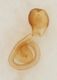 resized75-Atheta_orphana_g_5x_AB-2206492988380482048.jpg