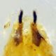 aedeagus part.JPG