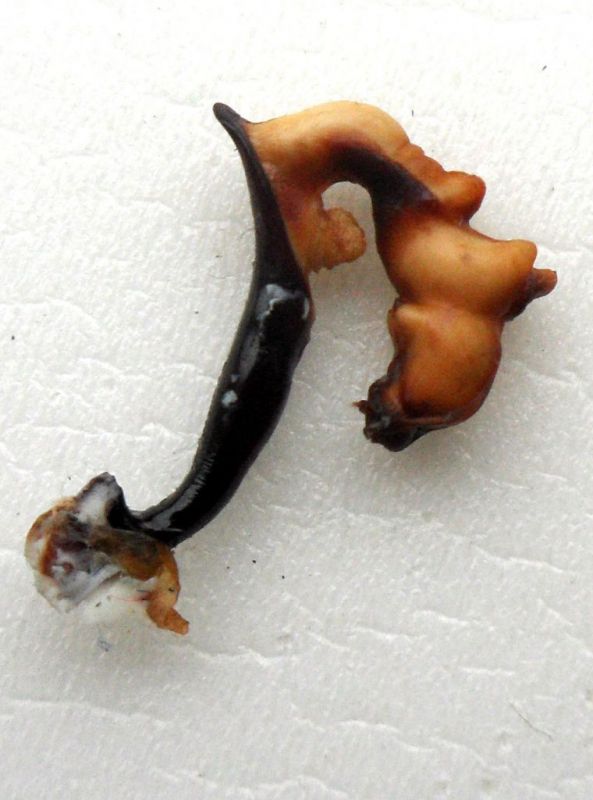 Genitalia. Procerus caucasicus antonkozlovi, 3.JPG