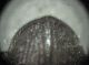 Cal particol addome 001.jpg