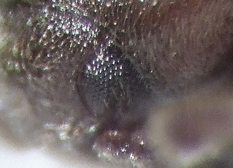 Cal particol occhio 002.jpg